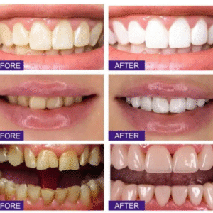 Probiotic Whitening Toothpaste